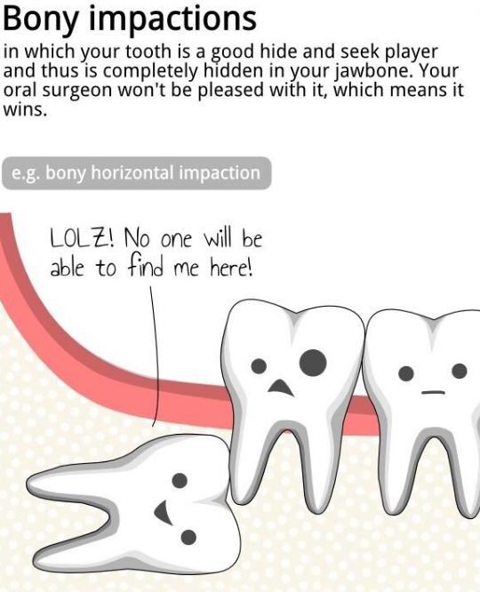 Fun Facts About Wisdom Teeth